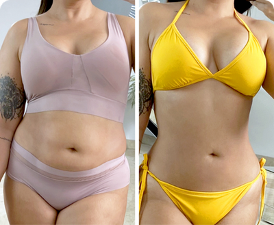 Antes y despues Lucia | Redu Sculpt Transformación corporal antes y después de usar Redu Sculpt mostrando cintura más definida