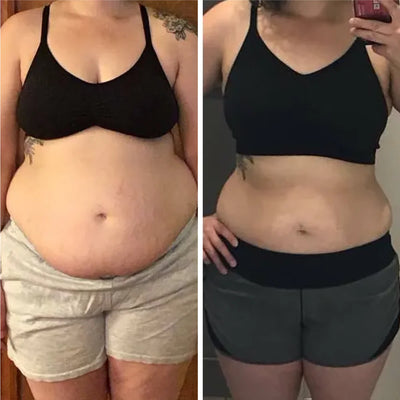 Antes y despues Carolina | Redu Sculpt Resultados visibles de reducción de abdomen y medidas con Redu Sculpt