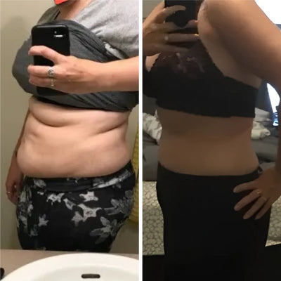 Antes y despues Paola | Redu Sculpt Transformación antes y después en abdomen con el uso de Redu Sculpt mostrando reducción de medidas