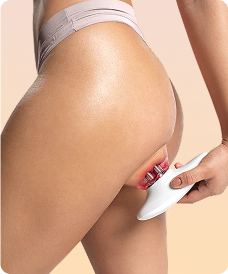 Moldea Glúteos | Redu Sculpt Uso de Redu Sculpt en los glúteos para mejorar la firmeza y reducir celulitis